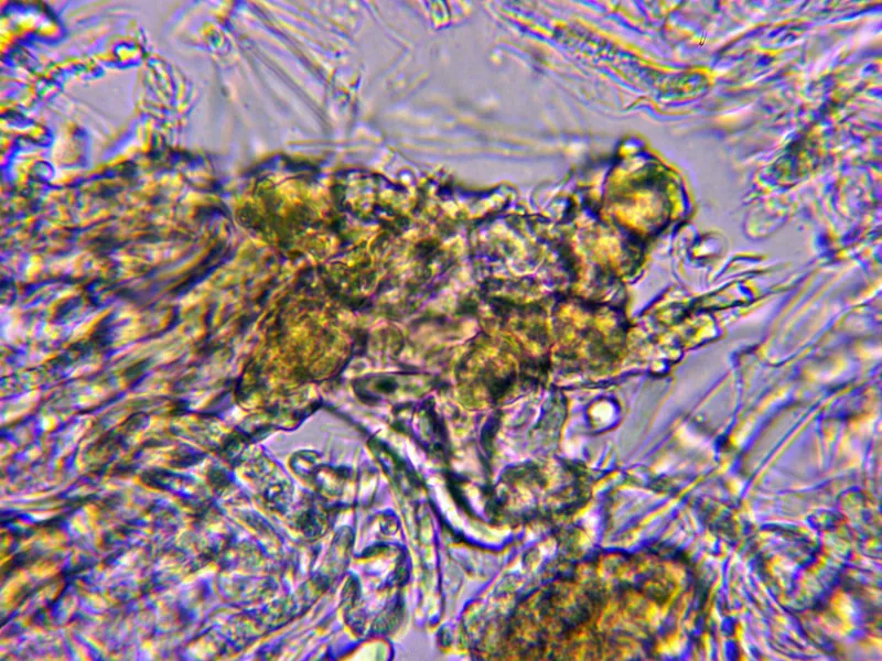 Albatrellopsis confluens 20 - Pigmento cutícula